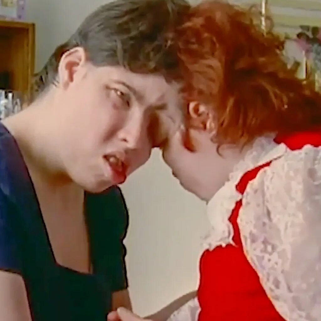 Близнецы лори и джордж шапелл. Лори и джордж сиамские близнецы. Близнецы джордж и лори шеппел. Лори и дори (джордж) шэппель. Сиамские близнецы лори и джордж шапелл.