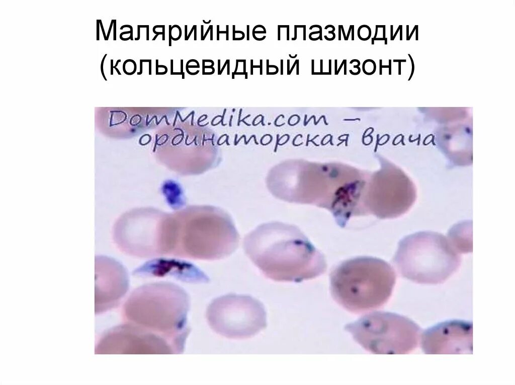 Трофозоит малярийного плазмодия. Кольцевидный шизонт. Трофозоит шизонт. Шизонт малярийного плазмодия строение. Шизонт это