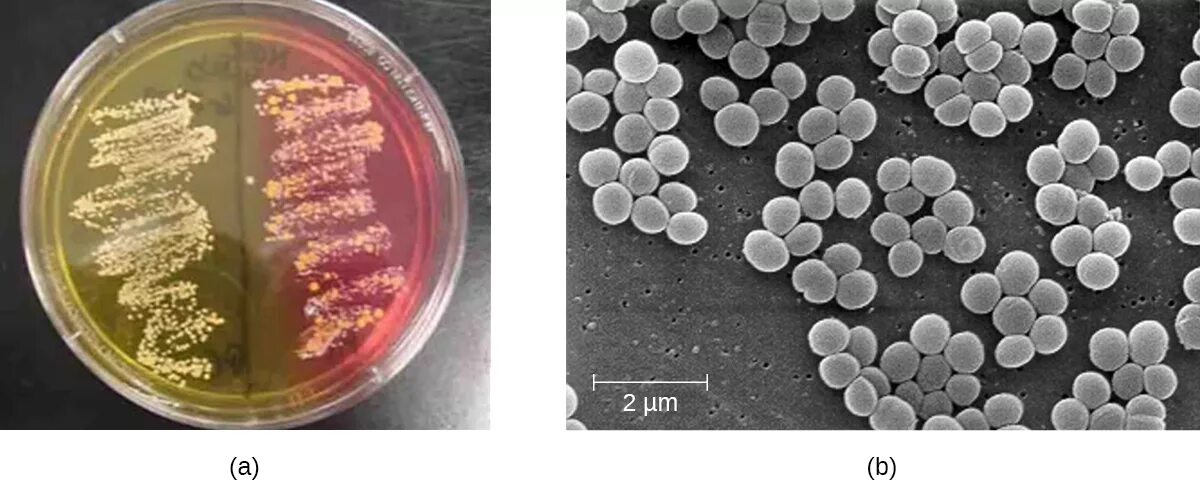 Врачи золотистый стафилококк. S. aureus золотистый стафилококк. Метициллин-резистентный золотистый стафилококк. Золотистый стафилококк микробиология. Маннитол золотистый стафилококк.