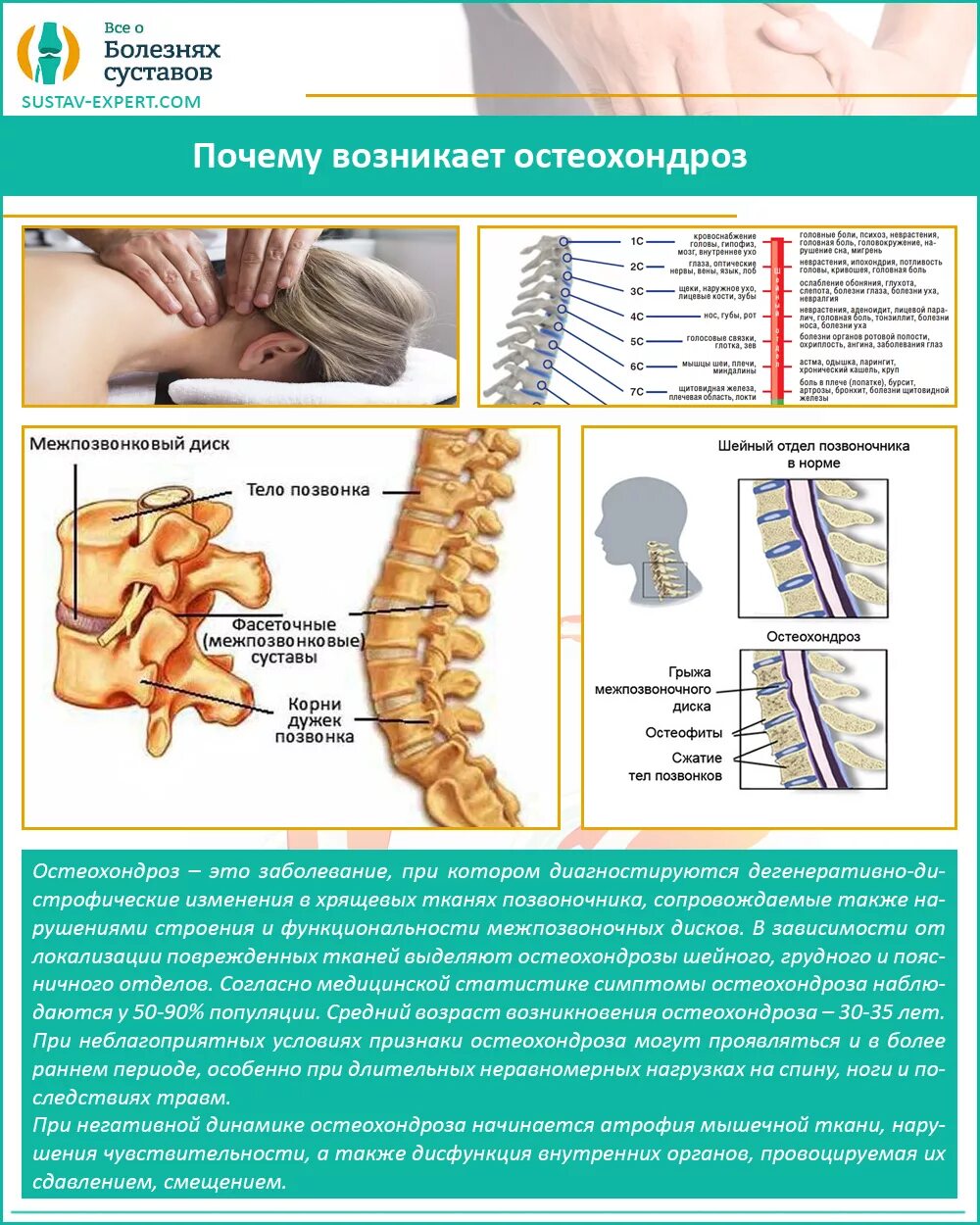 Остеохондроз позвоночника у взрослых шейного отдела. Заболевания позвоночника. Остеохондроз шейного отдела позвоночника. Грудной отдел позвоночника. Остеохондроз позвоночного отдела.