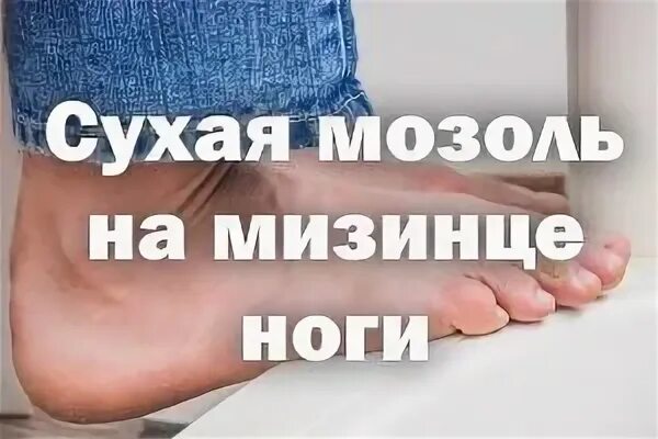 Как избавиться сухих