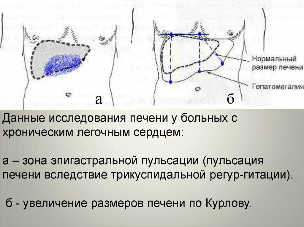 Какие размеры печени