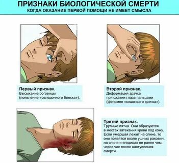 Признаки жизни лица