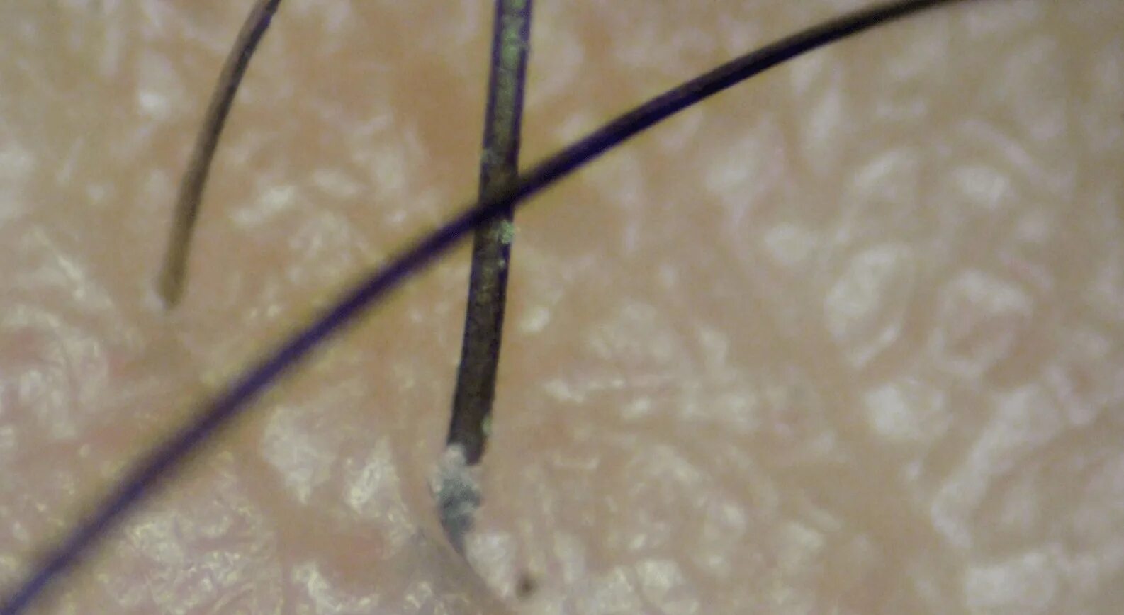 Волосяная луковица микроскопом. Луковица волоса под микроскопом. Кожа головы под микроскопом. Волосяная луковица под микроскопом.