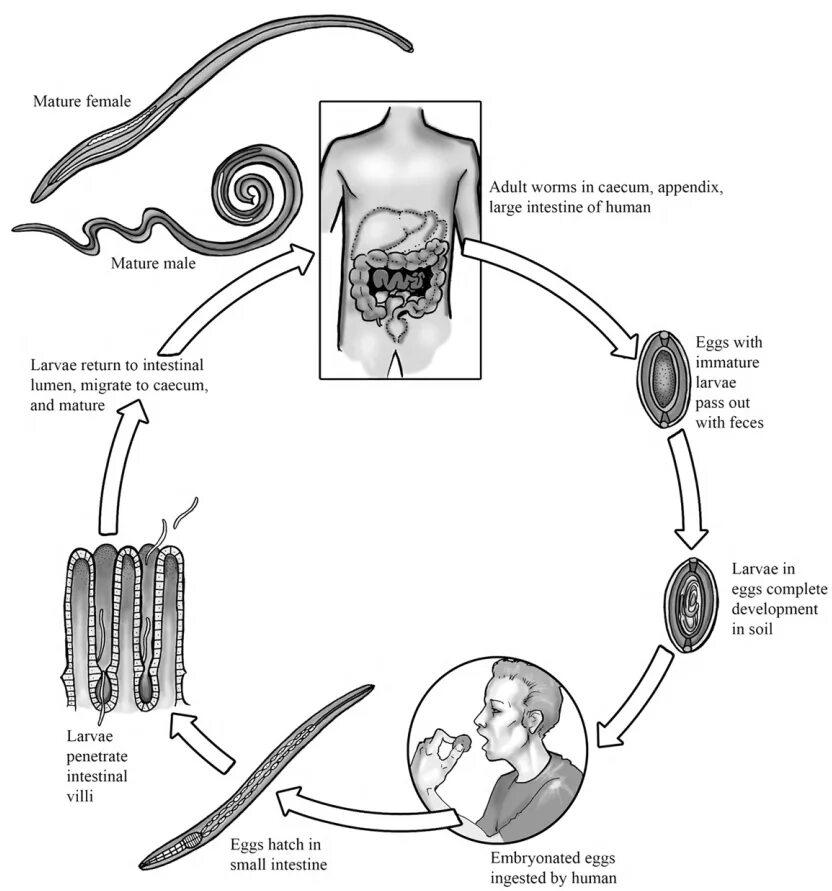 Жизненный цикл трихинеллы схема. Жизненный цикл власоглава схема. Цикл развития трихинеллы схема. Трихинеллез жизненный цикл.