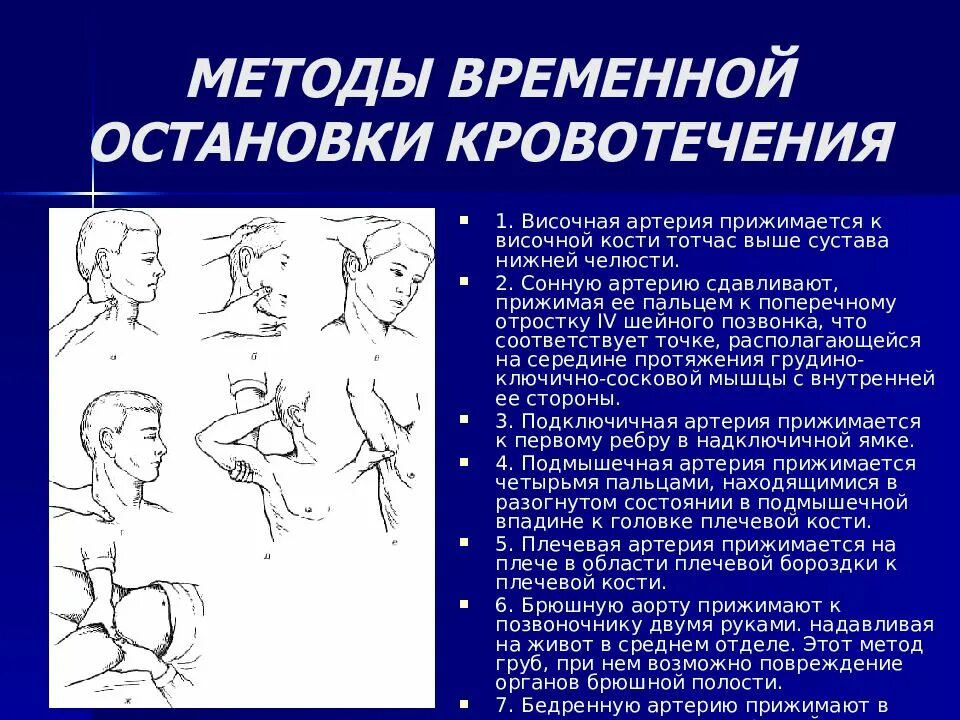 Остановить кровотечение на сонной артерии ответ тест. Временная остановка кровотечения из сонной артерии. Способы временной остановки кровотечения из сонной артерии. Остановка кровотечения сонной артерии. Остановка кровотечения при ранении сонной артерии.