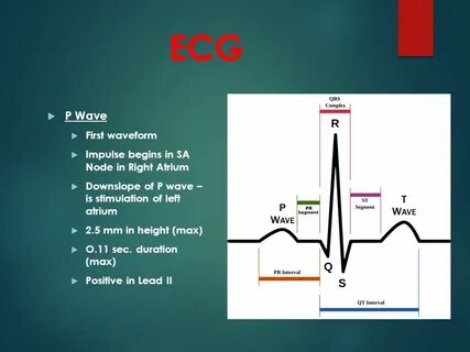 Комплекс qrs