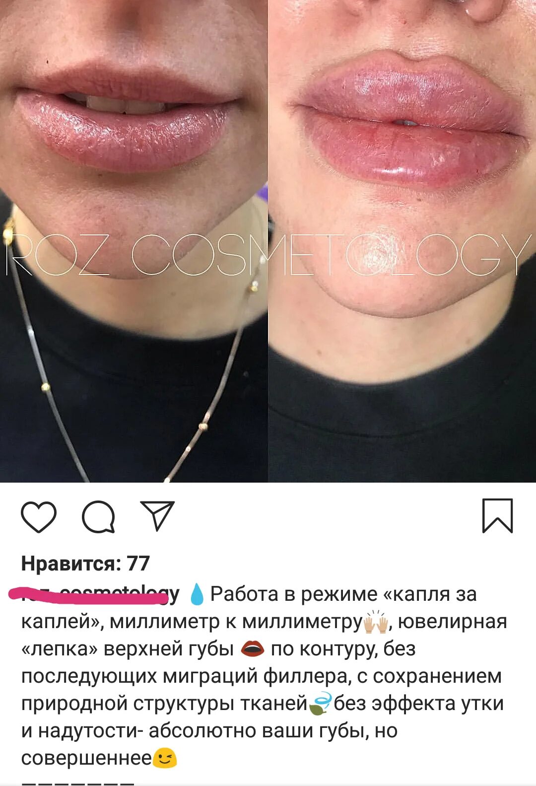 Цитаты про губы. Цитаты про губы