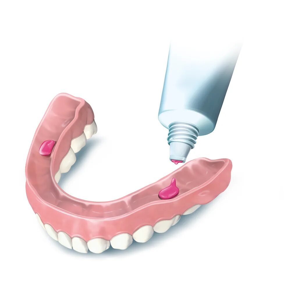 Как правильно наносить корегу на протез. Фиксатор для протезов. Фиксатор для зубных съемных протезов. Гелевые протезы для зубов.