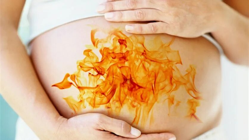 При изжоге беременным. Изжога причины. Изжога при беременности. Изжога в третьем. Изжога причины.