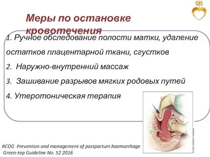 Ручной осмотр