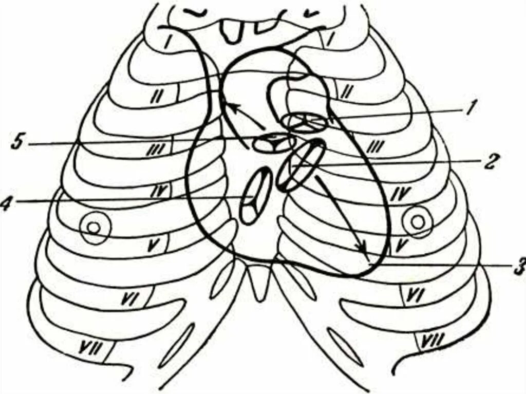 Скелетотопия клапанов сердца. Границы сердца скелетотопия. Скелетотопия отверстий сердца. Скелетотопия трехстворчатого клапана. Клапаны сердца на грудной клетке
