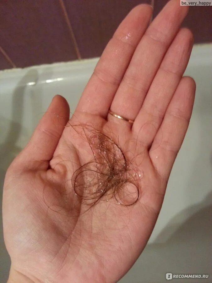 Норма выпадения при мытье. Норма выпадения волос. Норма выпавших волос при мытье. Норма выпадения волос после мытья. Выпадают волосы после мытья.