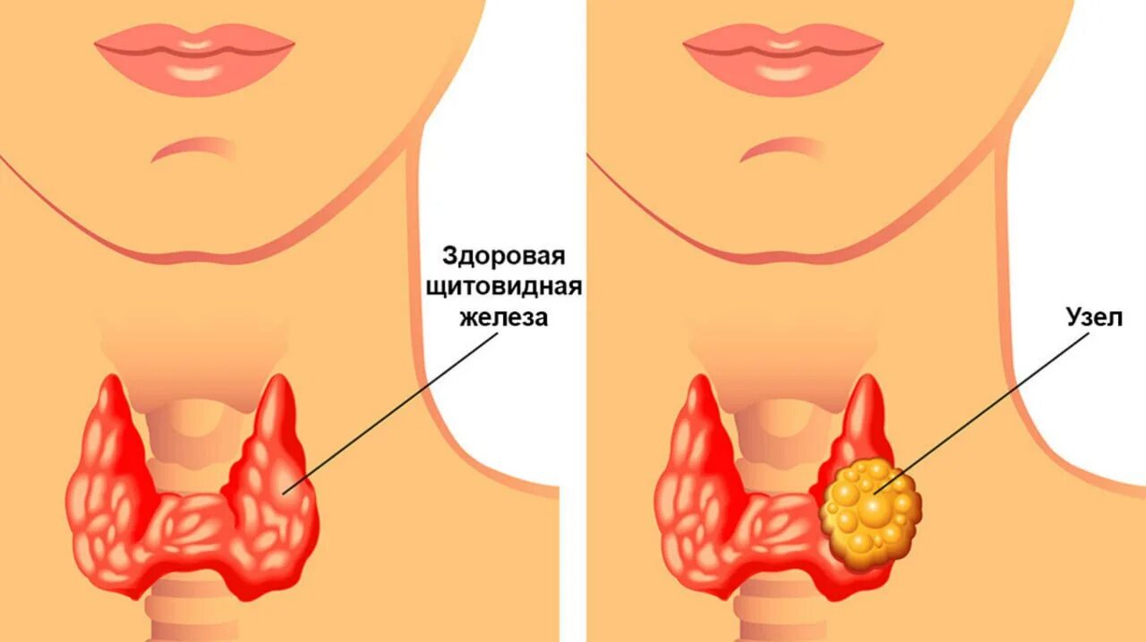 Как понять диффузно