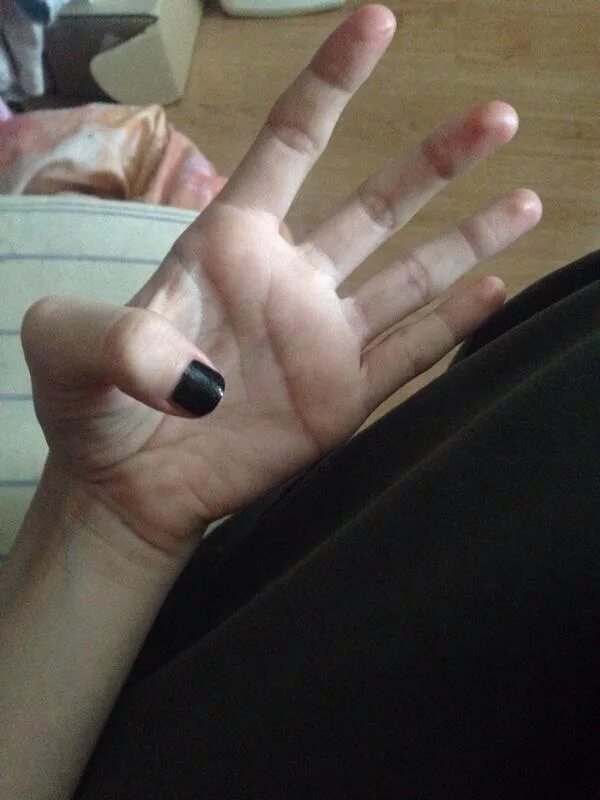 черный мизинец