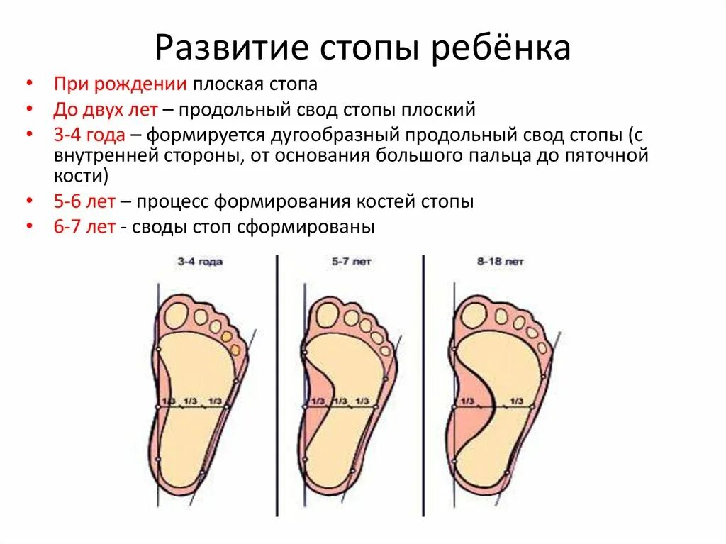 Средняя стопа. Формирование свода стопы. Формирование свода стопы начинается. Стопа ребенка в 3 года плоскостопие. Формирование свода стопы заканчивается.