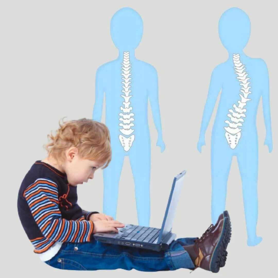 искривление позвоночника у детей к какому врачу