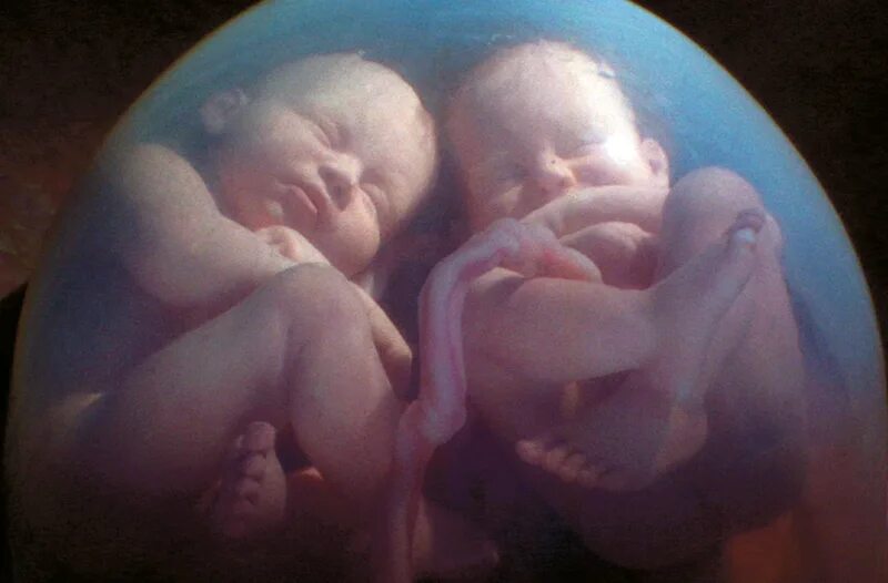 семимесячные близнецы.