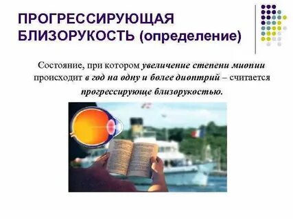 Высокая прогрессирующая миопия