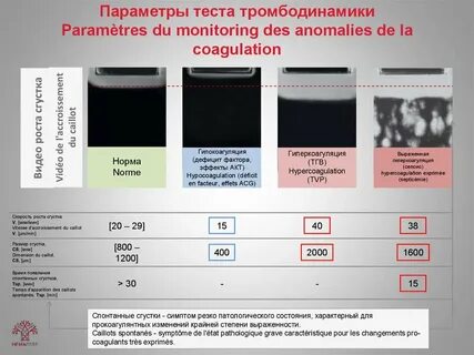 Тромбодинамика