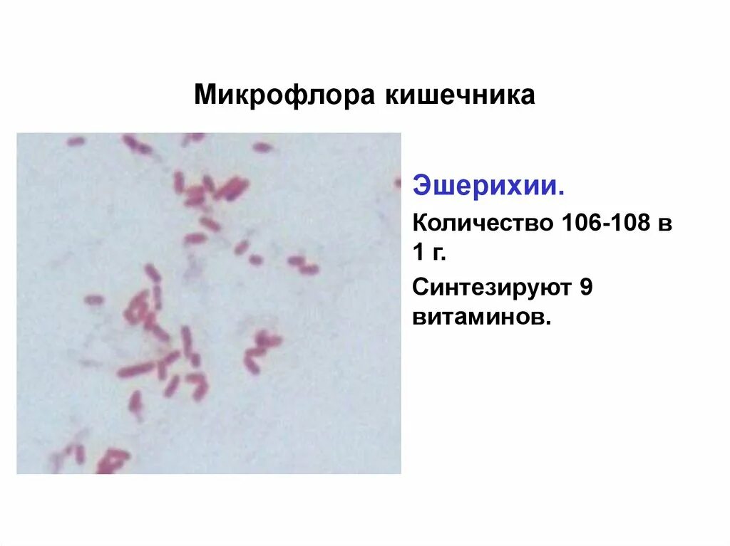 Норма кишечной палочки в моче у женщин. Escherichia coli в моче у женщин норма. Эшерихии морфология. Морфология эшерихии коли. Бак посев мочи escherichia coli 10 4.