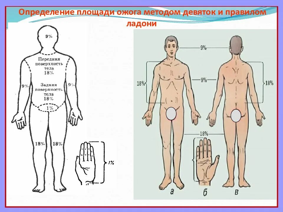 Правило 9 почему
