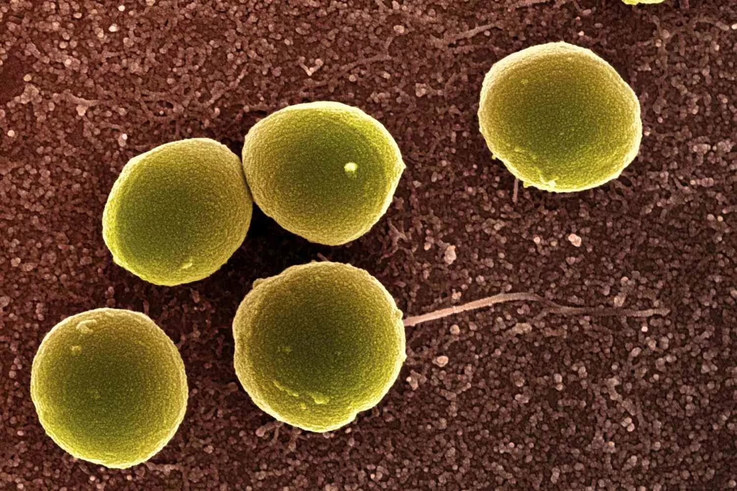 Бактерии округлой формы. Стафилококк золотистый Staphylococcus aureus. Микробы золотистый стафилококк. Шаровидные бактерии кокки. Золотистый стафилококк и стрептококк.