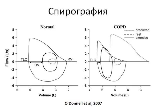 Данные спирографии. Данные спирографии
