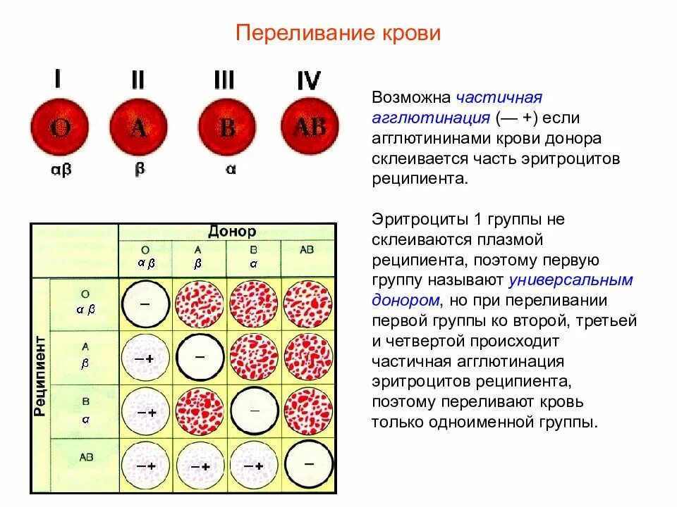 Гемотрансфузия группа крови. Сыворотка агглютинации 1 и 3 группы крови. Схема агглютинации ЕГЭ. Реакцию агглютинации клеток крови. Совмещение групп крови схема.