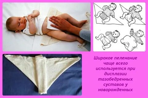 Широкое пеленание