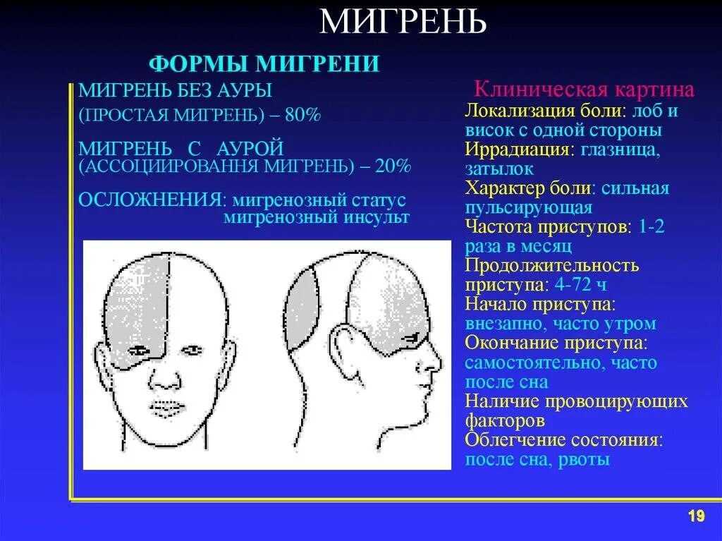 Мигрень. Мигренозоподобные головные боли. Головная боль локализация. Типы головной боли. Боли в правой височной области