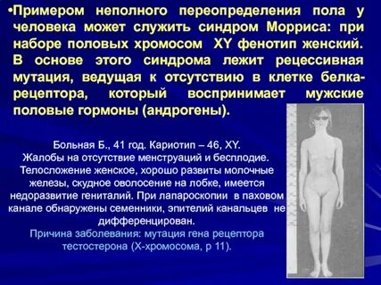 Синдром пол