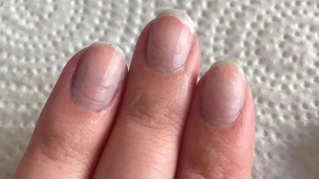 От чего синеют ногти