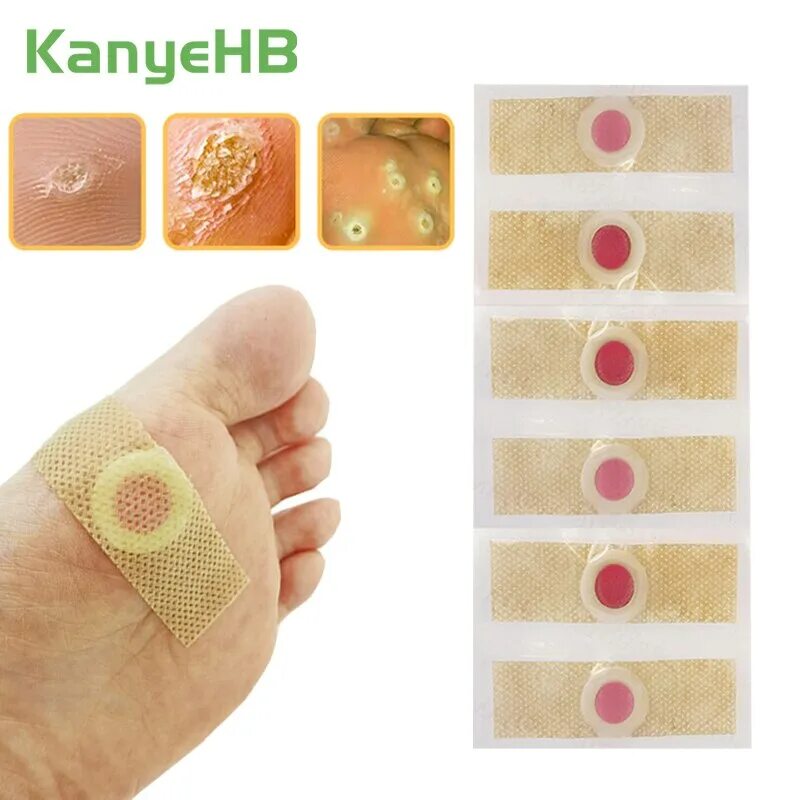 пластырь от стержневых. мозольный пластырь для стержневых. пластырь от стержневых мозолей как пользоваться. лейкопластырь от стержневых мозолей на ногах.