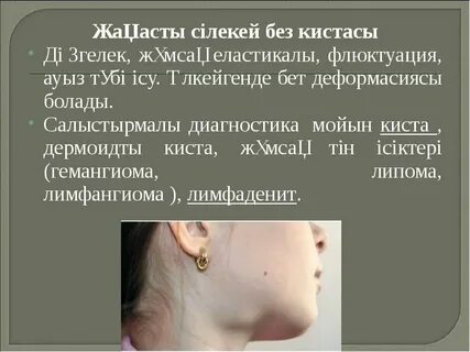 Анна Шупилова, порномодель