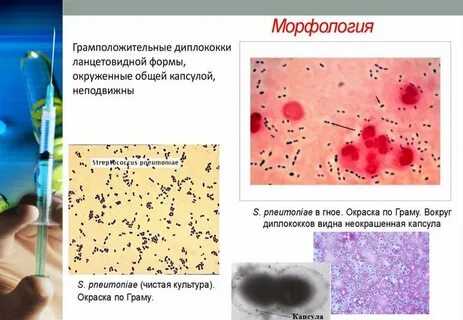 Диплококки в мазке у женщин