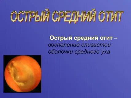 Острый левосторонний катаральный