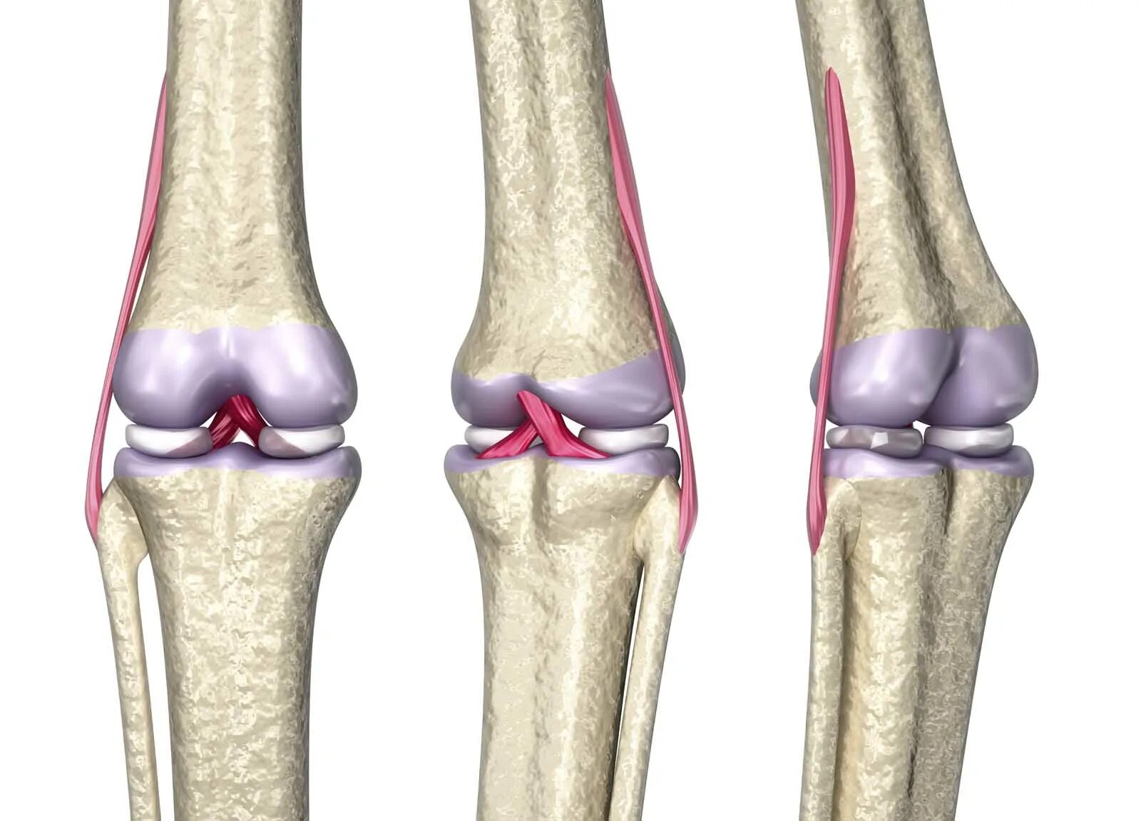 Коленный сустав 3д анатомия. Коленный сустав анатомия 3d. Растяжение латеральной связки коленного сустава. Разрыв подколенной связки.