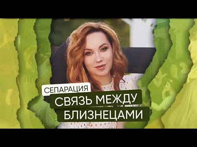 Разнояйцовые близнецы. Связь между близнецами. Презентация на тему близнецовый метод. Презентация на тему близнецовый метод. Близнецовый метод генетика схема.