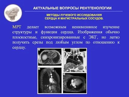 Методика исследования сердца