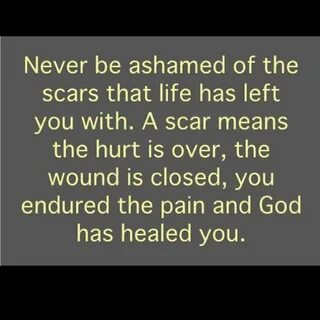 And that is life