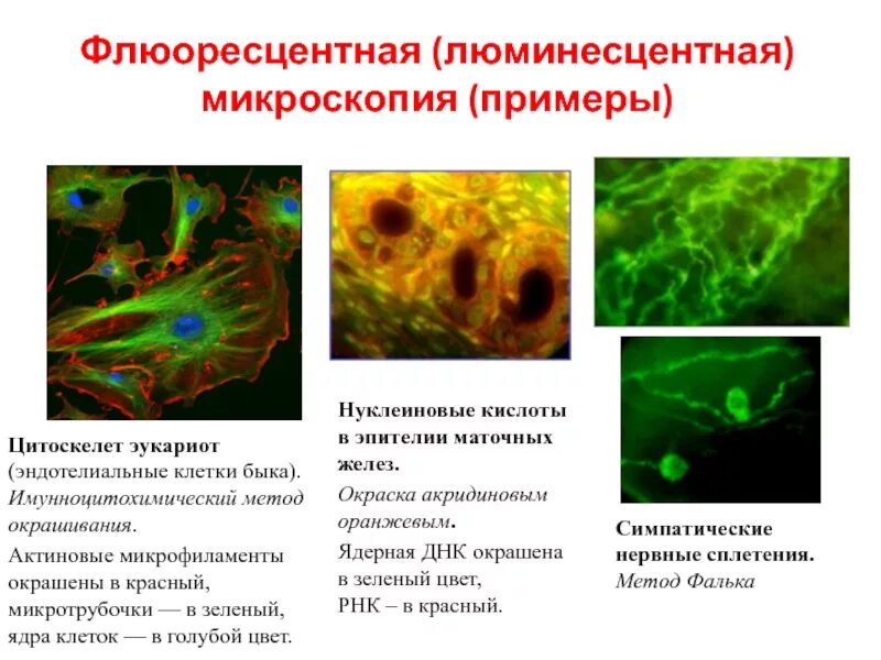 Микроскопия какой метод исследования. Люминесцентная микроскопия в гистологии. методика люминесцентной микроскопии. актиновые филаменты флуоресцентная микроскопия. гистология флуоресцентная микроскопия.
