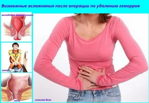 После операции геморроя: послеоперационный период лечения, отзывы