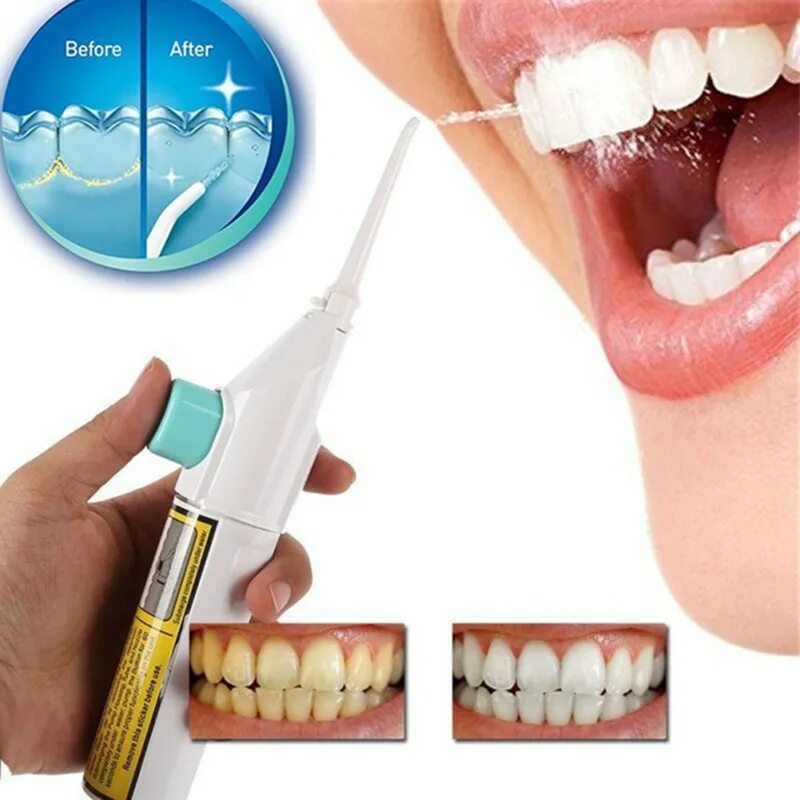 Гигиена десен. Ирригатор Power Floss. Очиститель зубов ирригатор Power Floss. Ирригатор Dental Tools. Dental Tools ирригатор портативный.