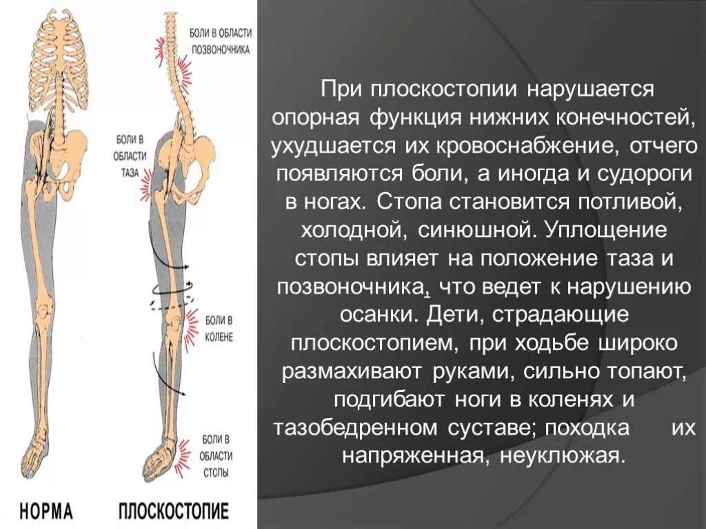 Что делает нижняя конечность. Опорная функция стопы. Плоскостопие нагрузка на позвоночник. Влияние плоскостопия на позвоночник. Нарушение функций нижних конечностей.