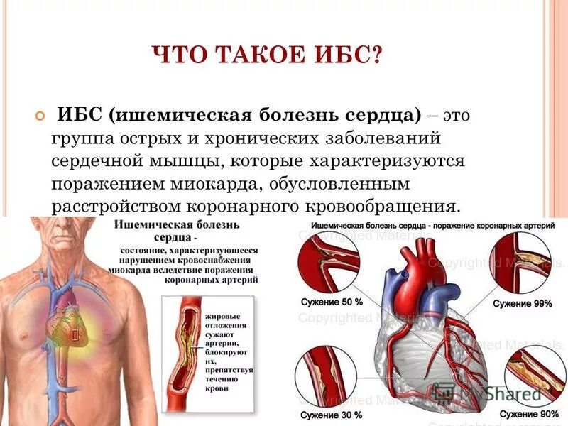 Ибс возраст. Ишемическая болезнь сердца (ибс). клинические проявления ишемической болезни сердца. ишемическая болезнь сердца поражение миокарда. проявления ишемической болезни сердца хронической и острой.