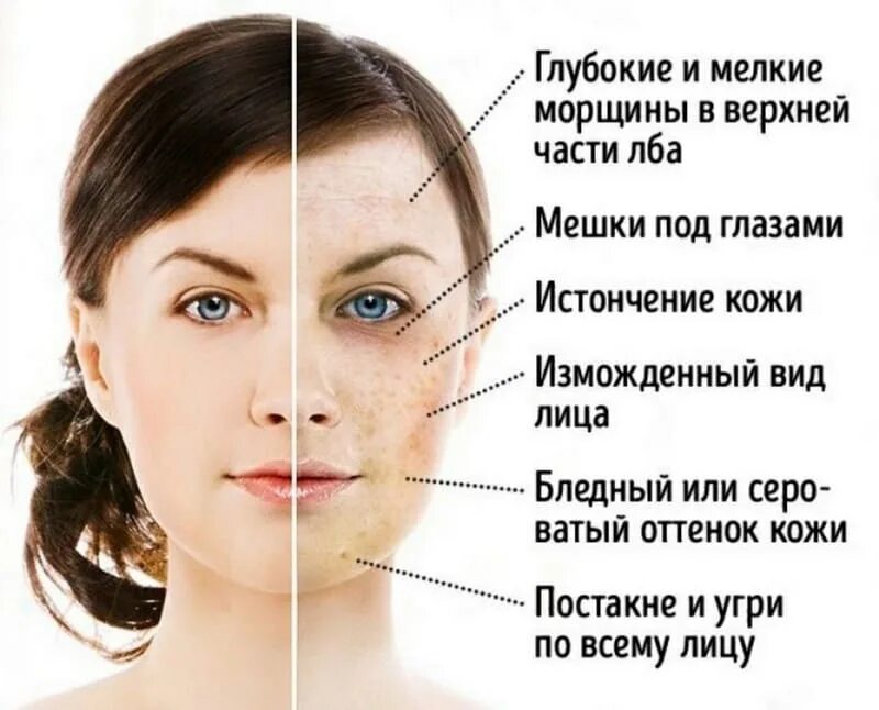 Стань кож. Сахарное лицо. сахарное старение кожи лица. морщины на лице.