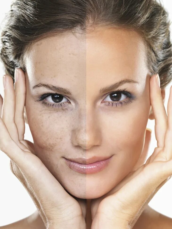 елена сметюх косметолог. красивое лицо косметология. гимнастика для лица. женское лицо. уход в 28 лет.