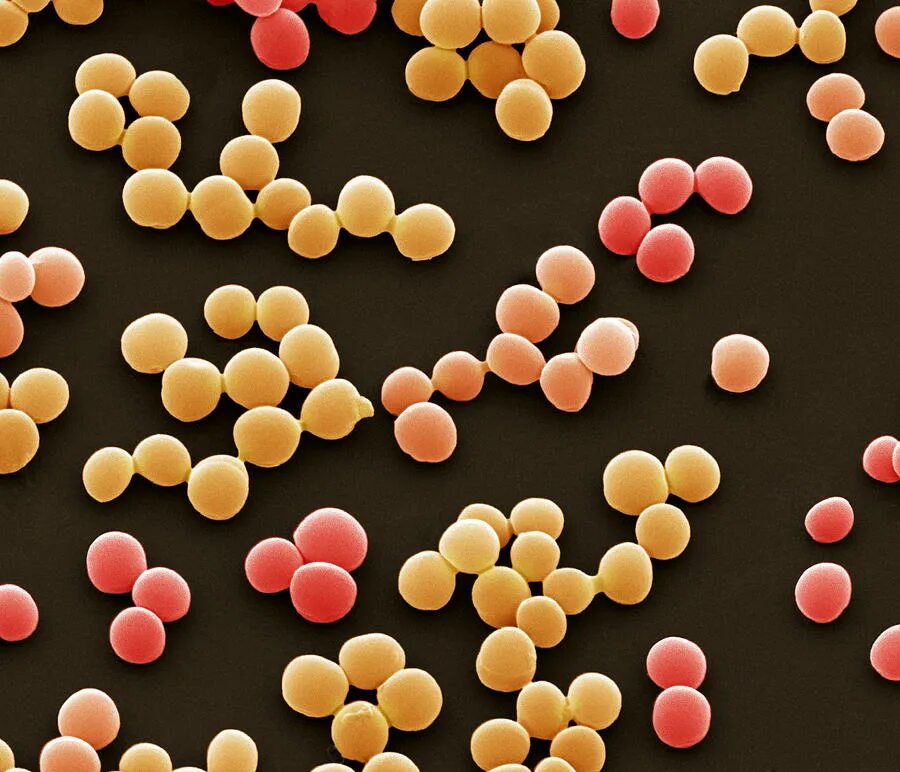 Enterococcus faecalis