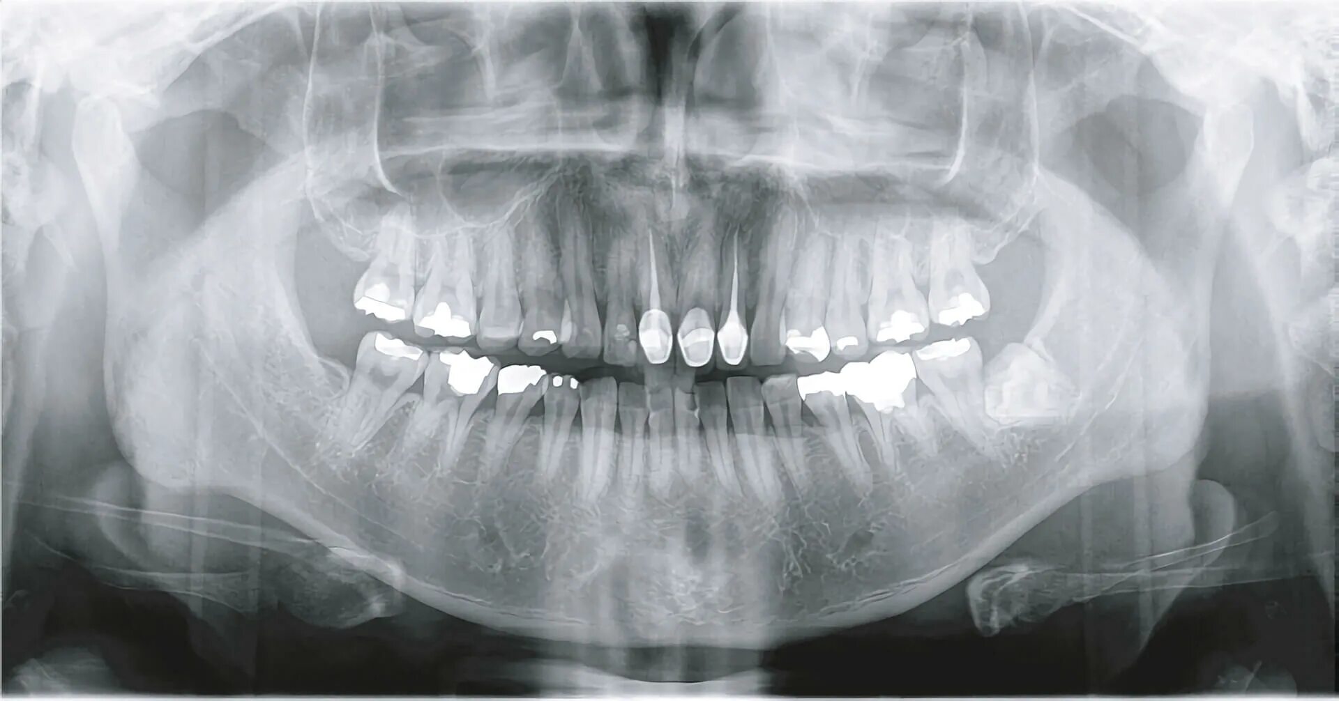 D a xray monolith. Papaya КЛКТ. Papaya томограф. Genoray Papaya 3d. Панорамный снимок 50 лет.